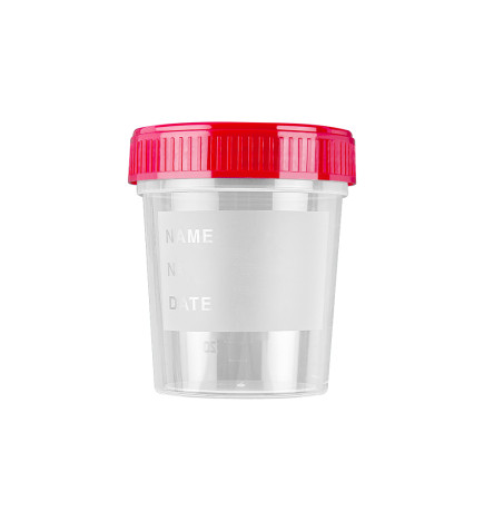 Contenitori per urine sterili da 150ml - Conf. 250 Pezzi
